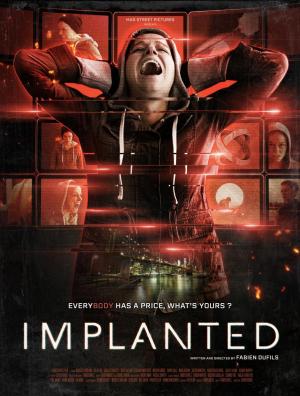 Implanted [Hindi]