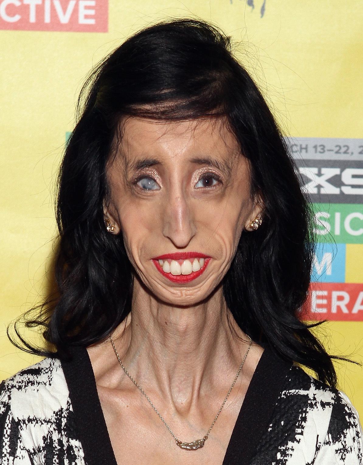 actor Lizzie Velasquez large photo