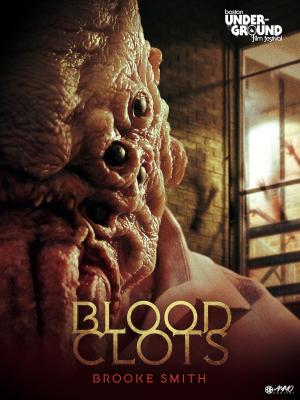 Blood Clots [Russian]