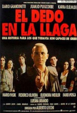 El dedo en la llaga [Spanish]