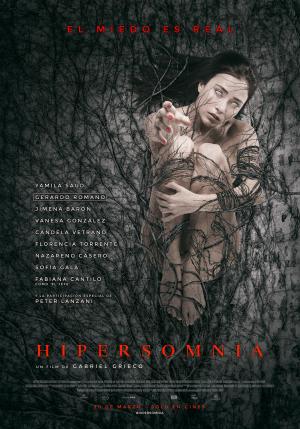 Hypersomnia [Indonesian]