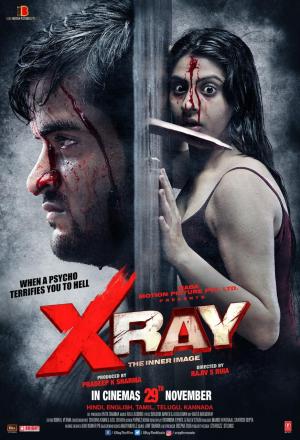 X Ray: The Inner Image [Hindi]