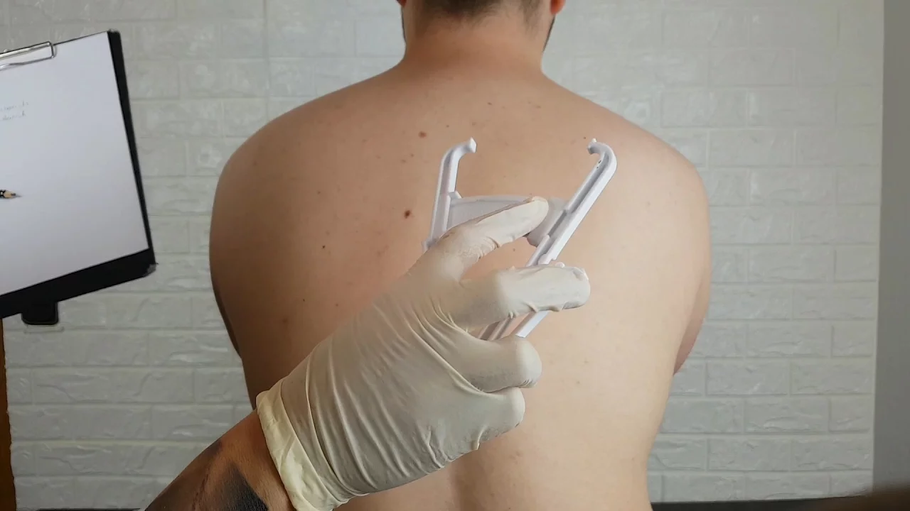 ASMR Real Person - Back Allergy Testing, Inspection & Check Up (2017) | Watch on Movi47