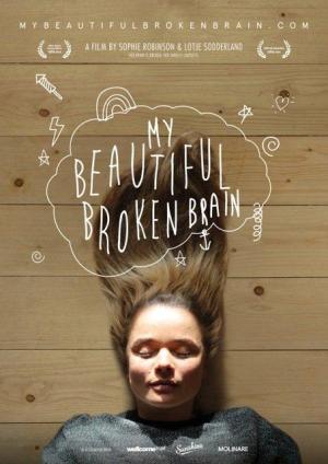 My Beautiful Broken Brain [ترجمة عربية]