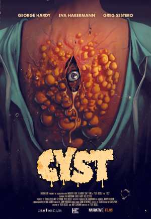 Cyst [Russian]