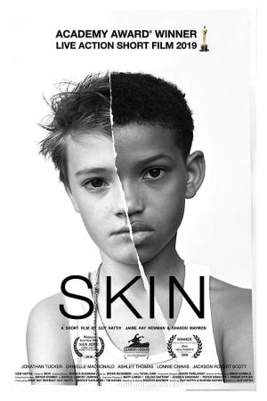 Skin [Russian]