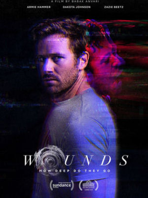 Wounds [Russian]
