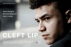 Cleft Lip [Russian]