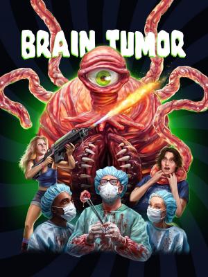 Brain Tumor [Indonesian]