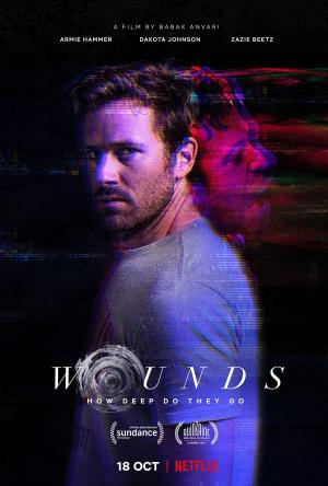 Wounds [Spanish]