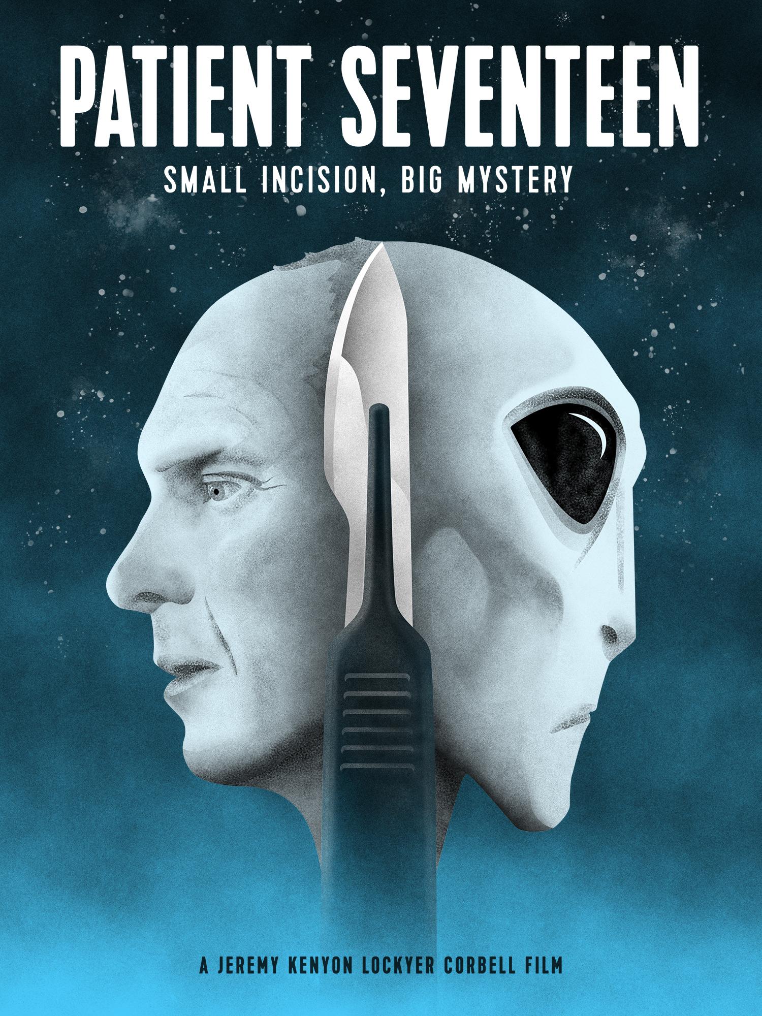 Patient Seventeen - like Investigation Alien but older