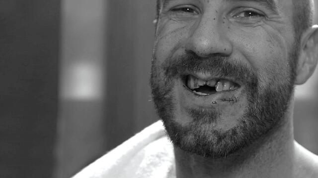 Cesaro receives stitches ahead of emergency dental work: WWE.com Exclusive, Sept. 24, 2017 background
