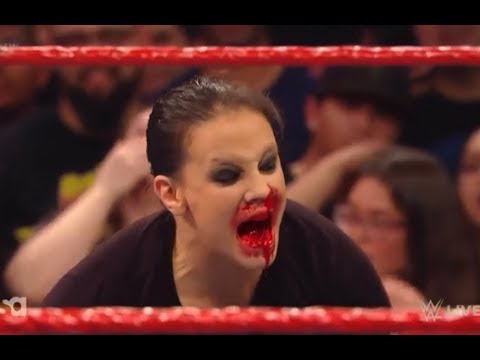 Shayna baszler attacks becky lynch😱🔞