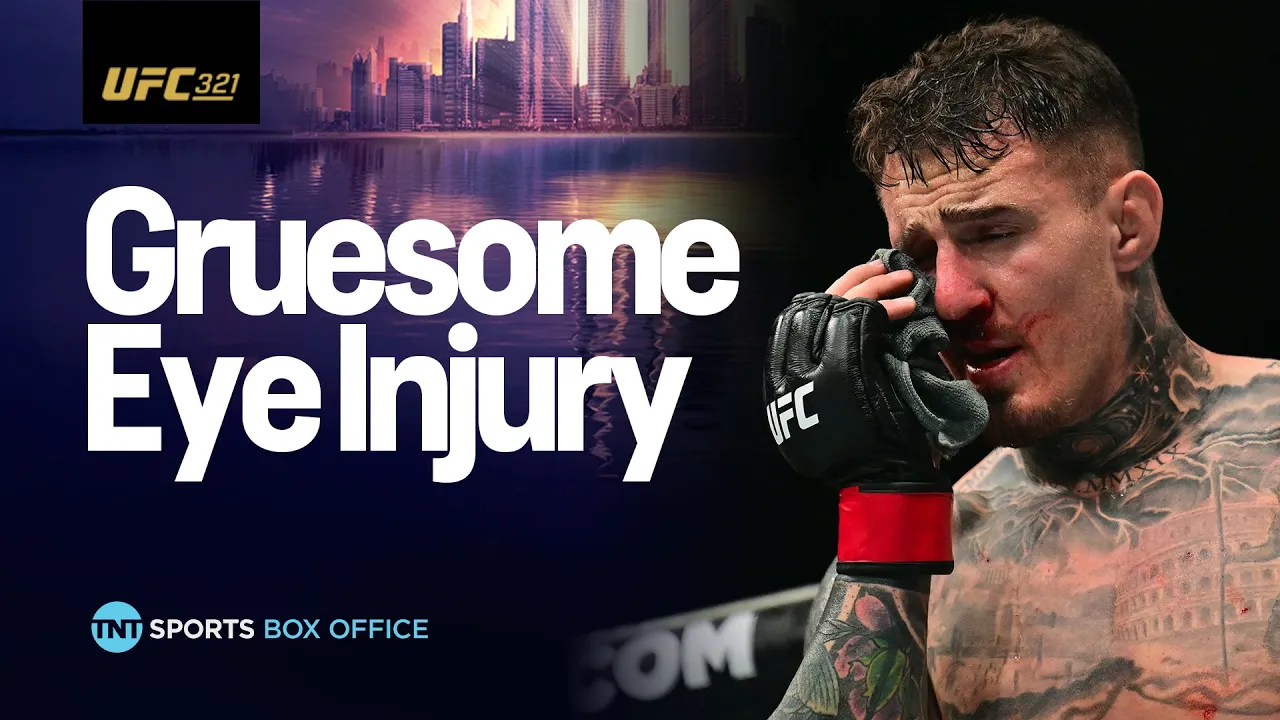 EMOTIONAL SCENES! Tom Aspinall retains title after eye injury forces no contest against Gane #UFC321