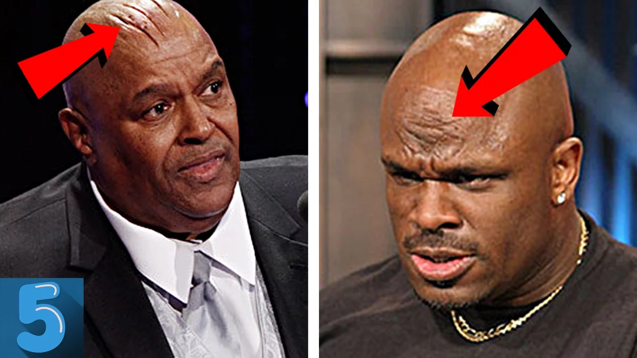 5 WWE Wrestlers Who Took Blading Too Far