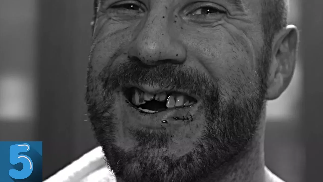 5 WWE Wrestlers Who Lost Teeth During A Match background