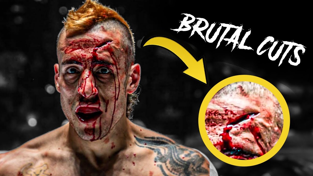 BRUTAL Fights That Ended With DEEP CUTS 😳