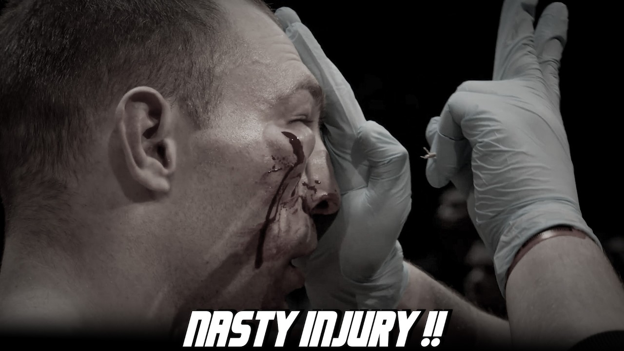 The Most RAW, BRUTAL Bare Knuckle Boxing of Top Dog 40 PART 2 | HIGHLIGHTS