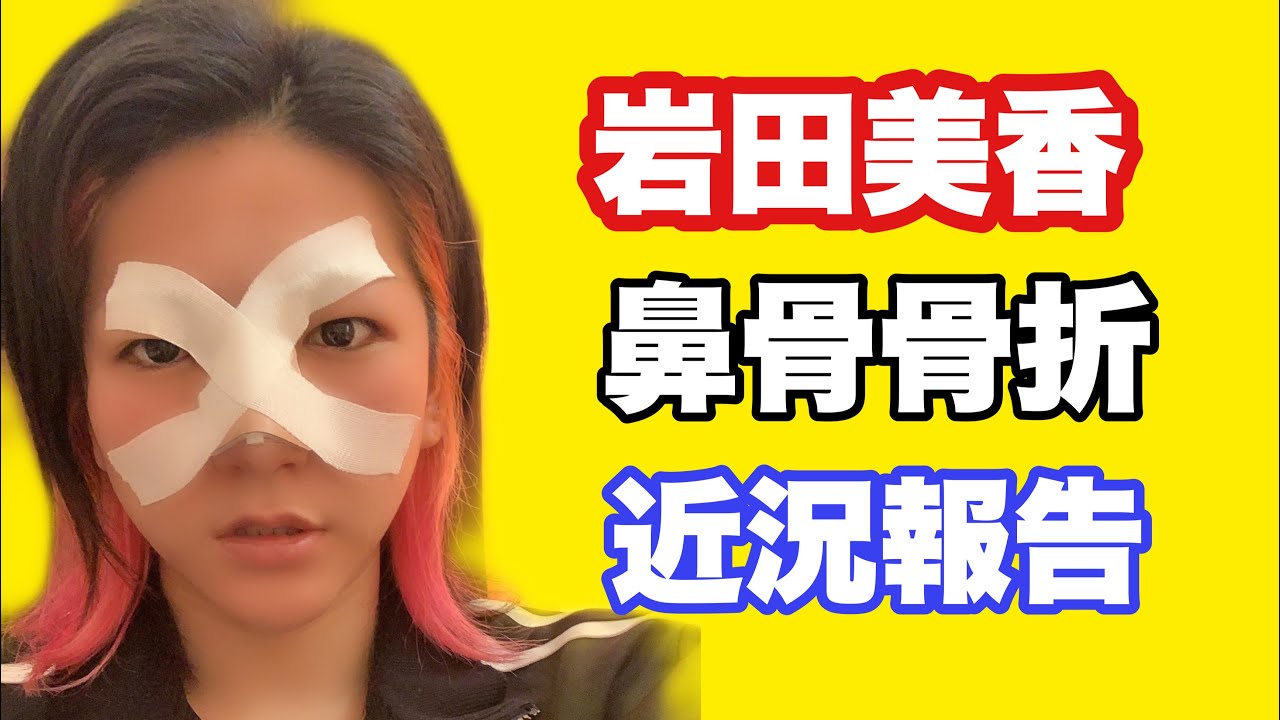【退院】岩田美香 鼻骨骨折 近況報告 background