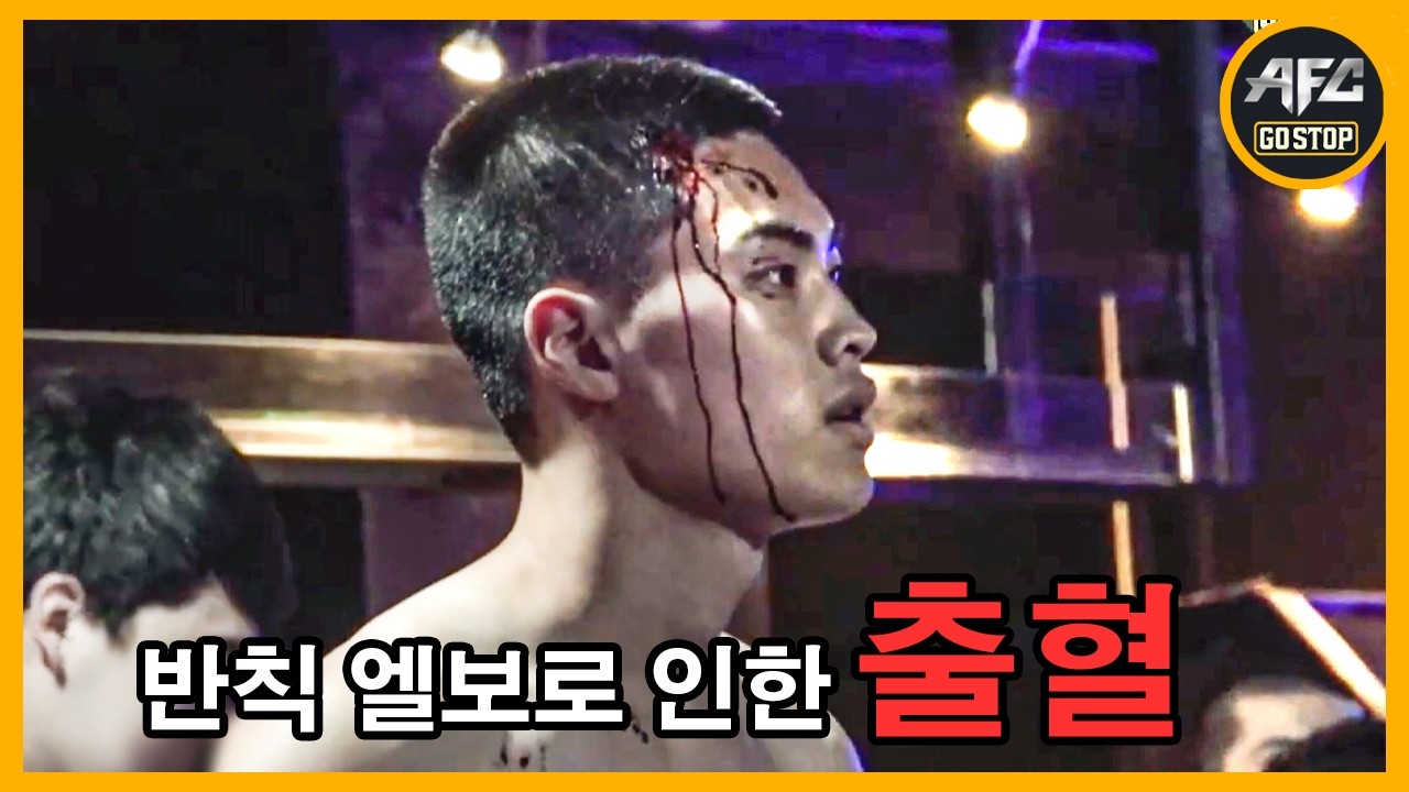 엘보 반칙으로 인한 유혈 사태 발생! 이대로 경기는?