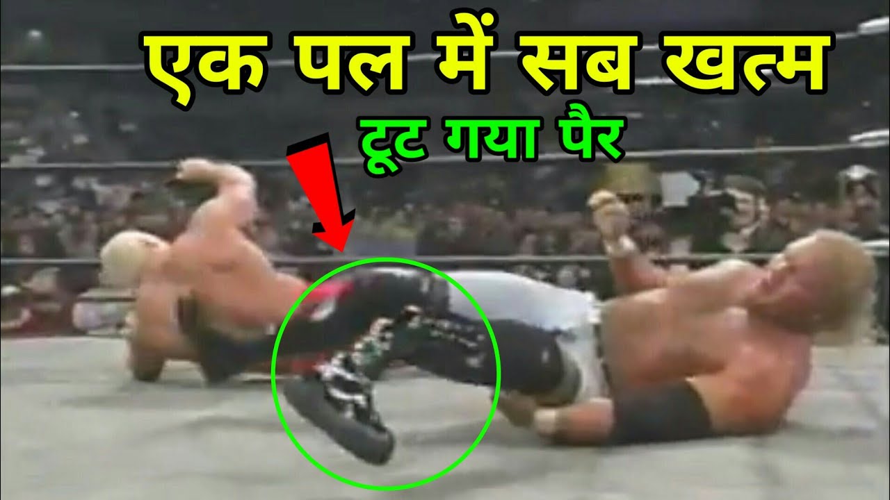 5 Most Shocking Leg Breaks in WWE History ! Wrestler's leg broken during match !