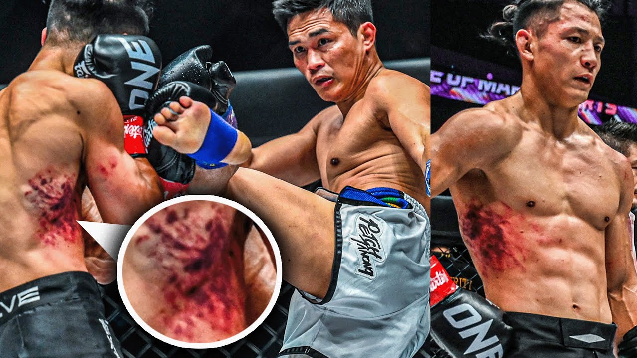 How Did Akimoto Survive Petchtanongâs Body Shots!? đ± Fight Highlights background