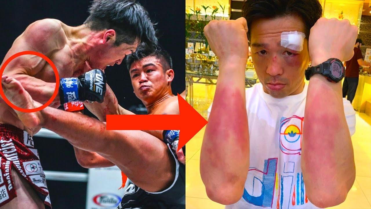 EXCRUCIATING KICKS 😨 Sangmanee vs. Yamada Was BRUTAL