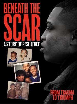 Beneath the Scar: A Story of Resilience [Indonesian]