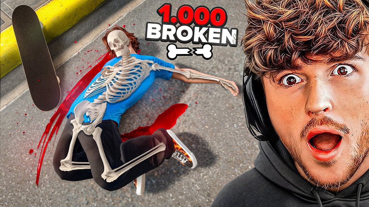 Breaking All 1000 BONES As a Professional Skateboarder! background