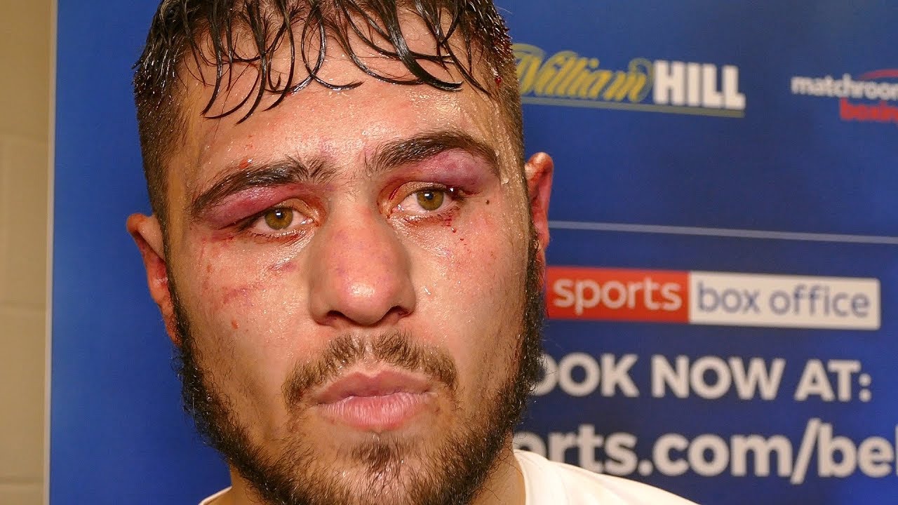 Dave Allen POST FIGHT PRESS CONFERENCE | vs. Ariel Esteban Bracamonte