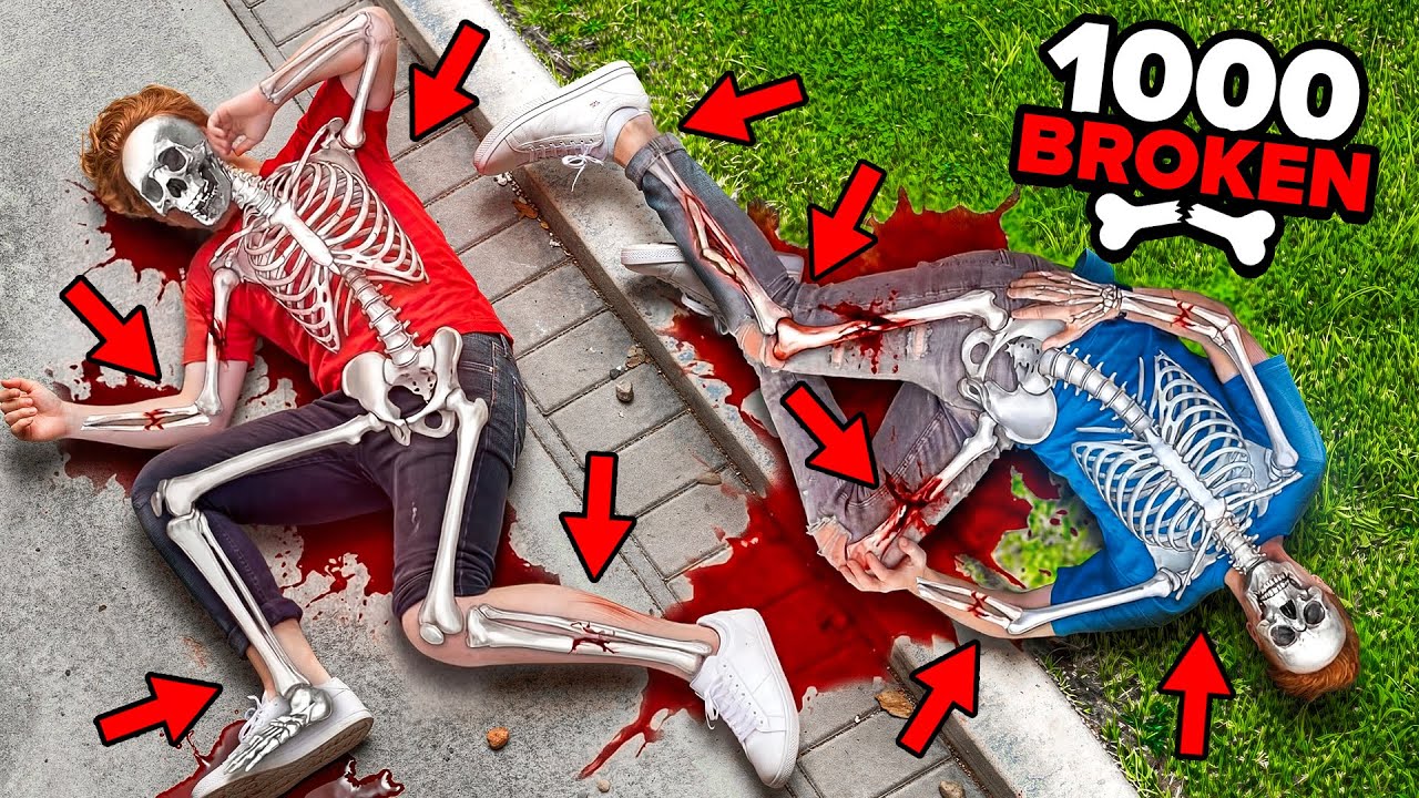 We Broke ALL 1,000 BONES in GTA 5 RP.. background