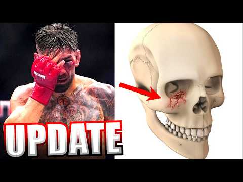 Will he be the Same? Ilia Topuria's Injury Update (Ilia Topuria vs Justin Gaethje)