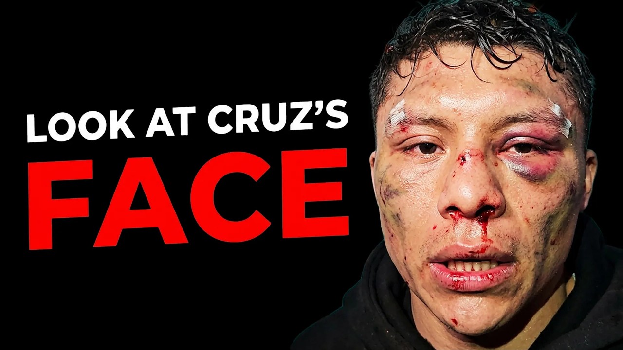 He Turned Cruz's Face Into A Bloody Mess.. BRUTAL Fight! background