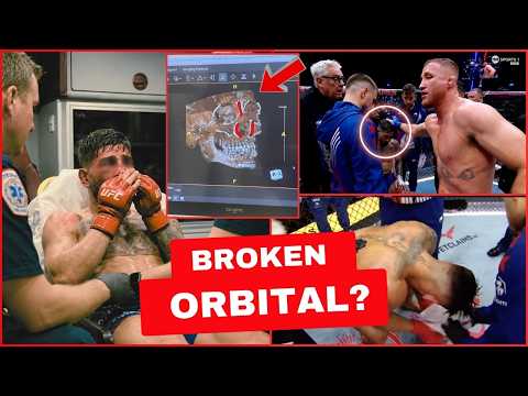 BREAKING: MMA World Is Only Now NOTICING What Happened At UFC White House Card! Ilia In BIG TROUBLE?