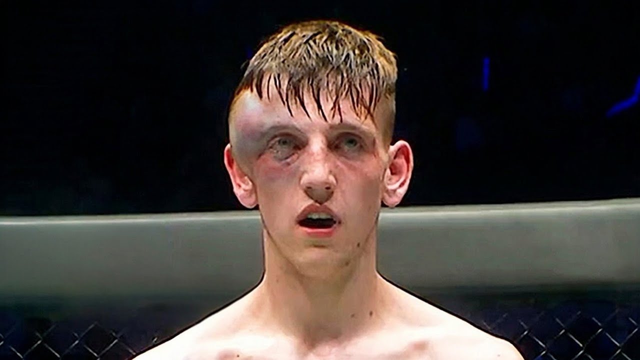 ROPermanent Damage! The MMA Horrors Of Human Destruction...