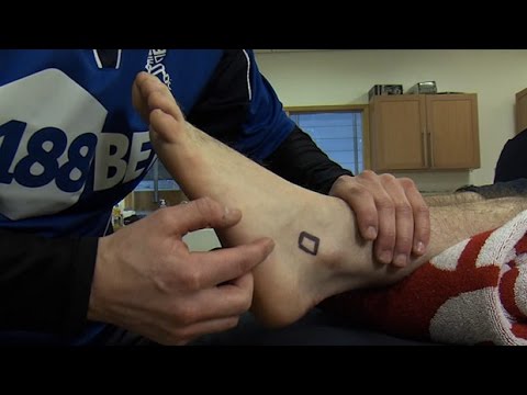 Injury clinic | twisted ankle symptoms explained