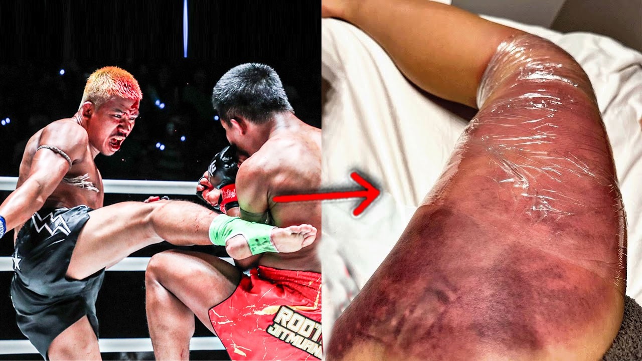 Nobody Could Survive his Legs – Superlek Kiatmoo9