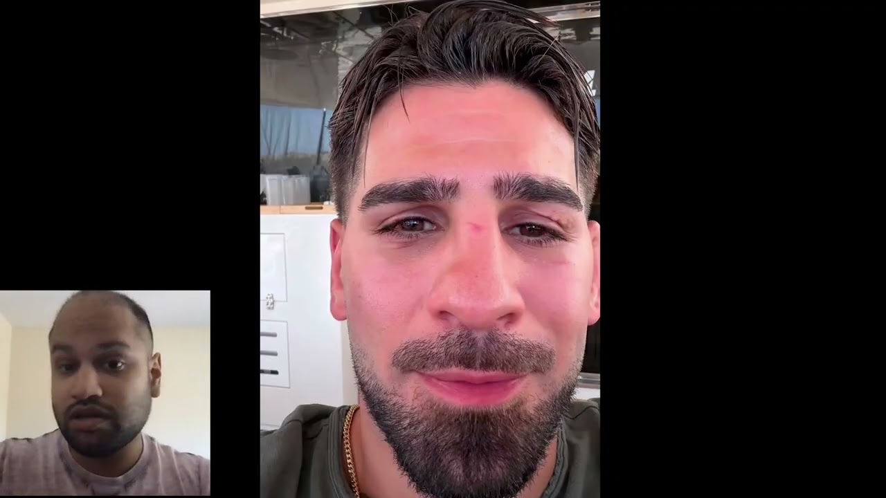 Ilia Topuria's Face After Justin Gaethje Broke It